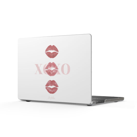 XOXO - MacBook Case